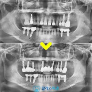 노원치과