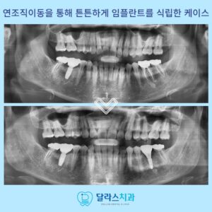 노원역치과