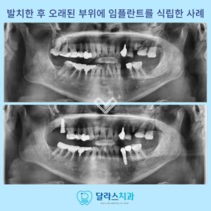 노원역치과추천