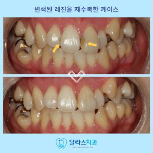 노원치과