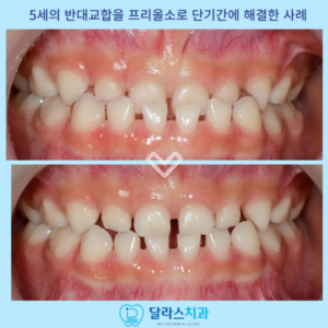 노원치아교정