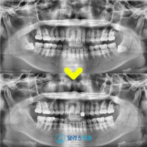 노원역치과