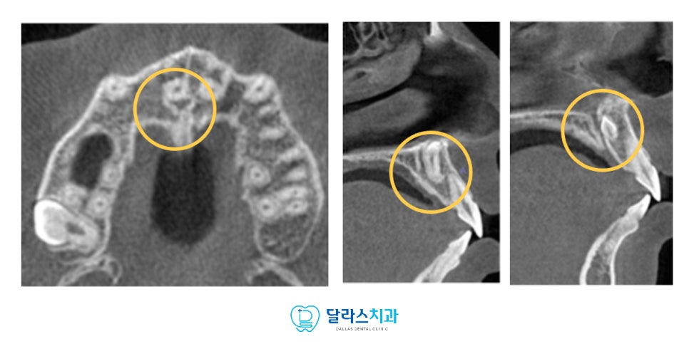 노원치과