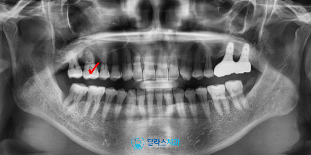 노원역치과