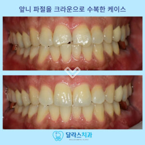 노원역치과