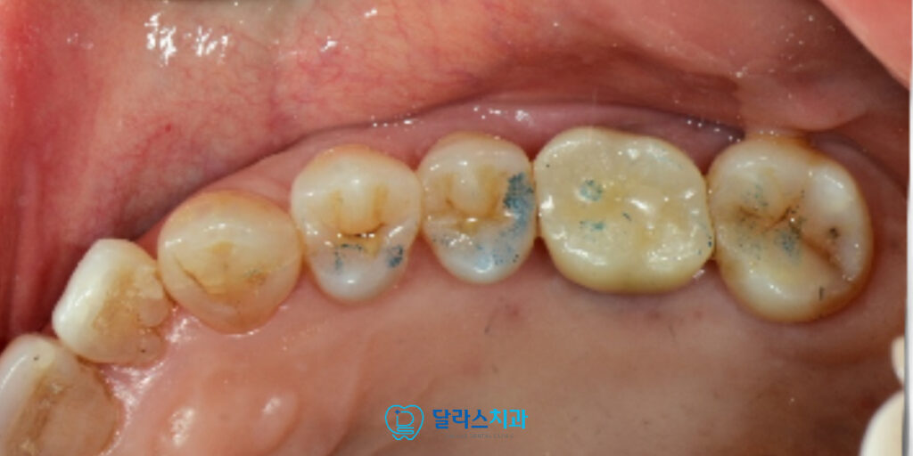 노원역치과
