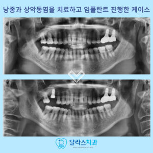 노원역치과