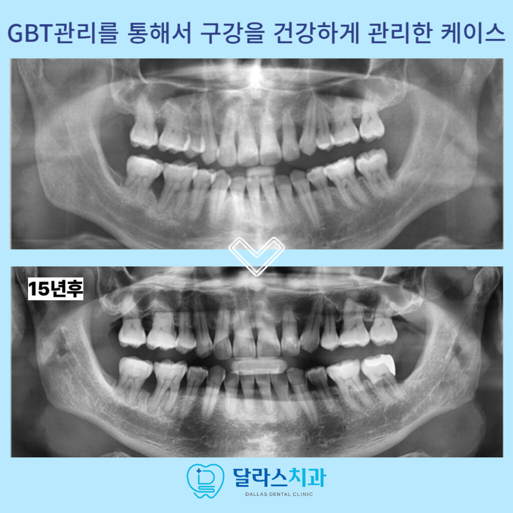 노원치과