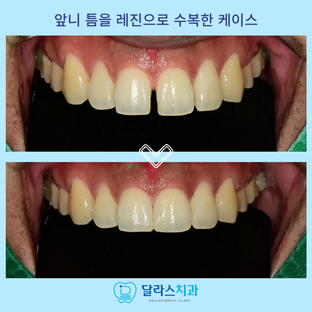 달라스치과