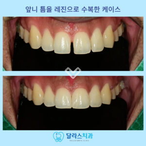 달라스치과