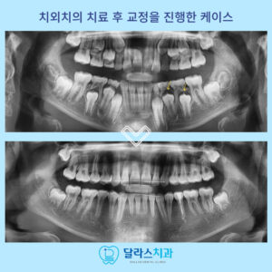 노원치과