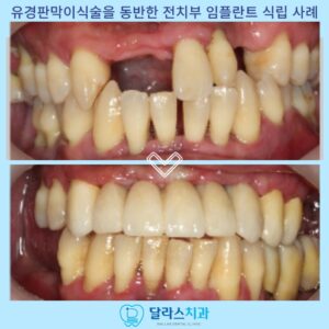 노원역치과