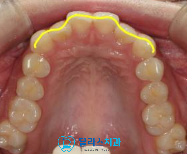 노원치아교정