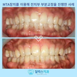 노원치과