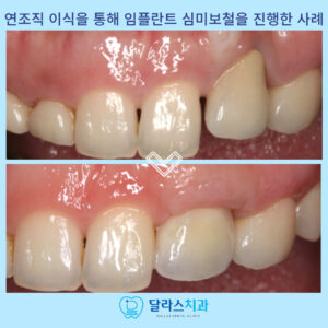 노원치과