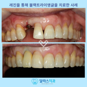 노원치과