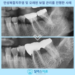 노원치과