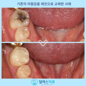 노원치과