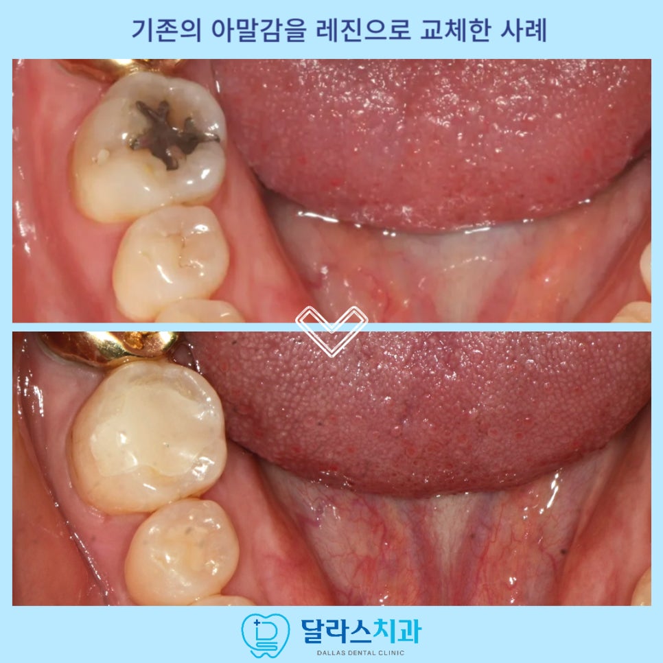 노원치과