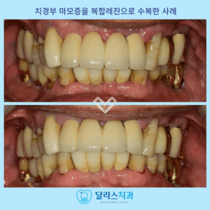 노원치과