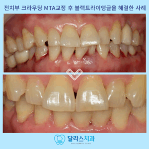 노원치과
