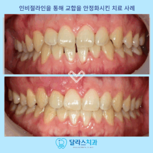 노원역교정치과