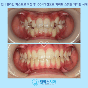 노원역교정치과
