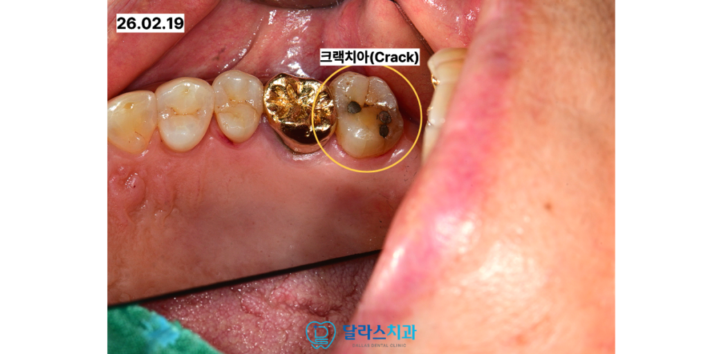 달라스치과