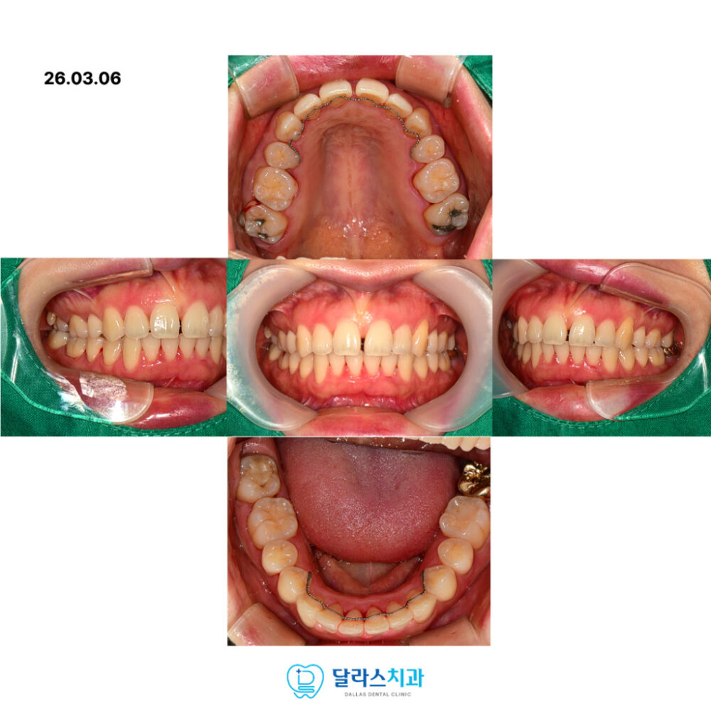 노원치과