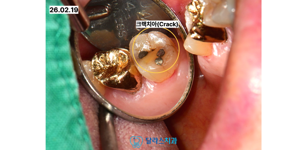 달라스치과