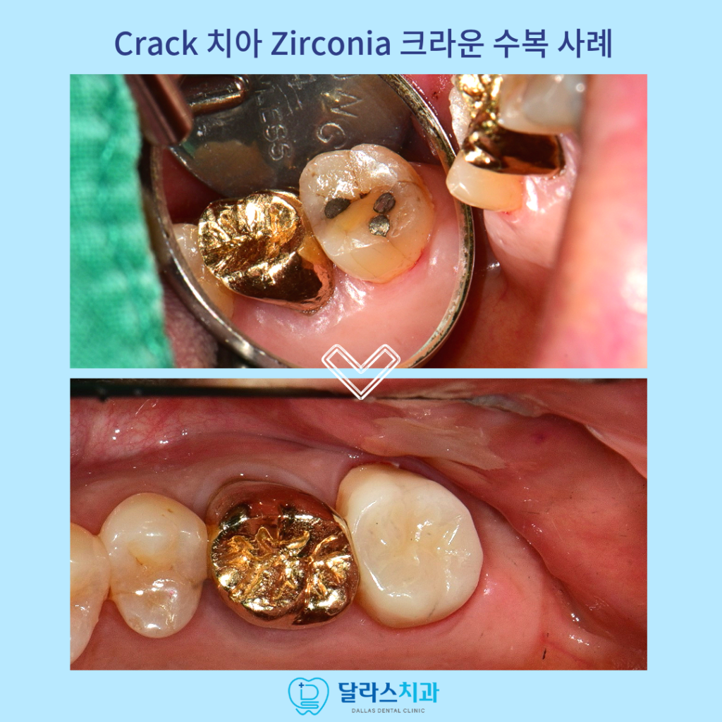 달라스치과