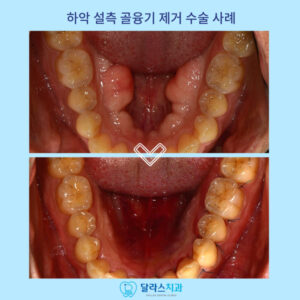 노원치과
