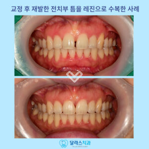 노원치과