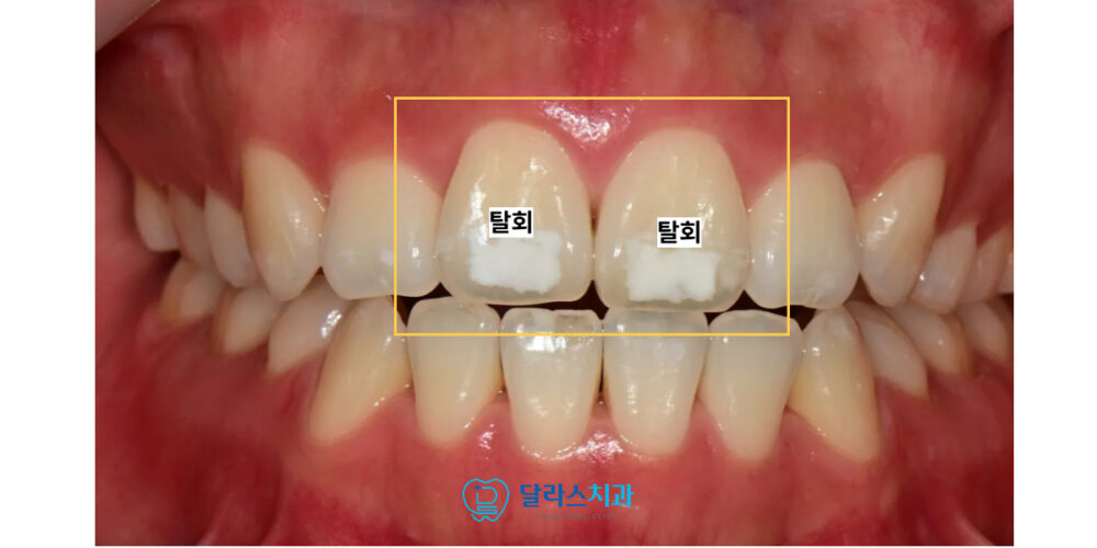 노원치과