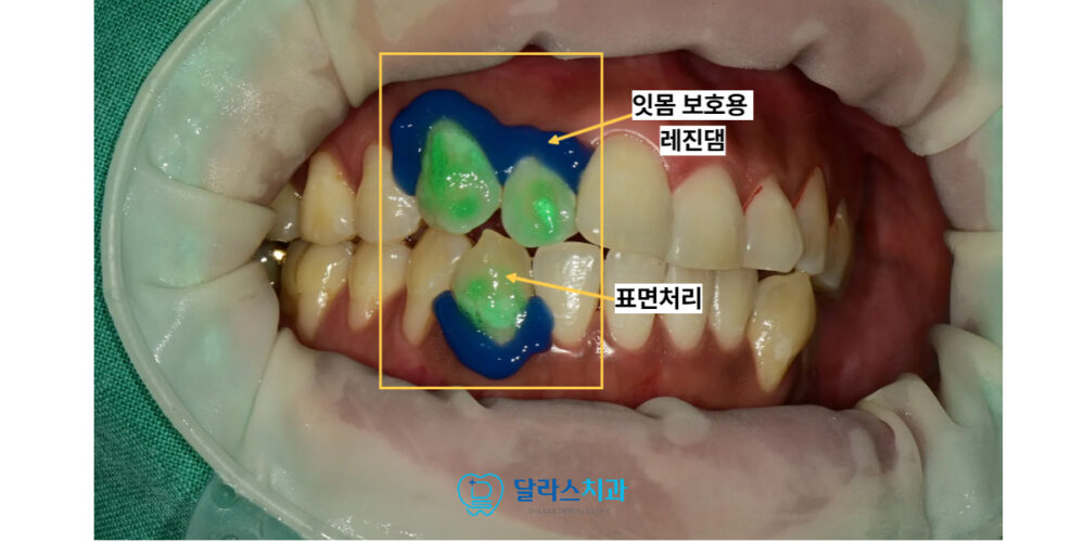 노원치과