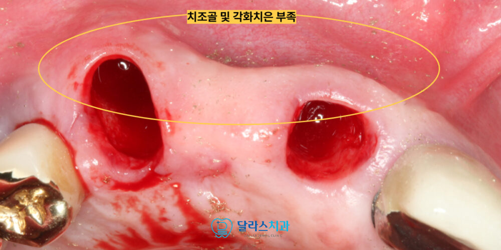 노원치과