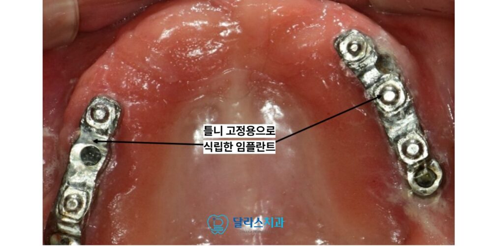 노원치과