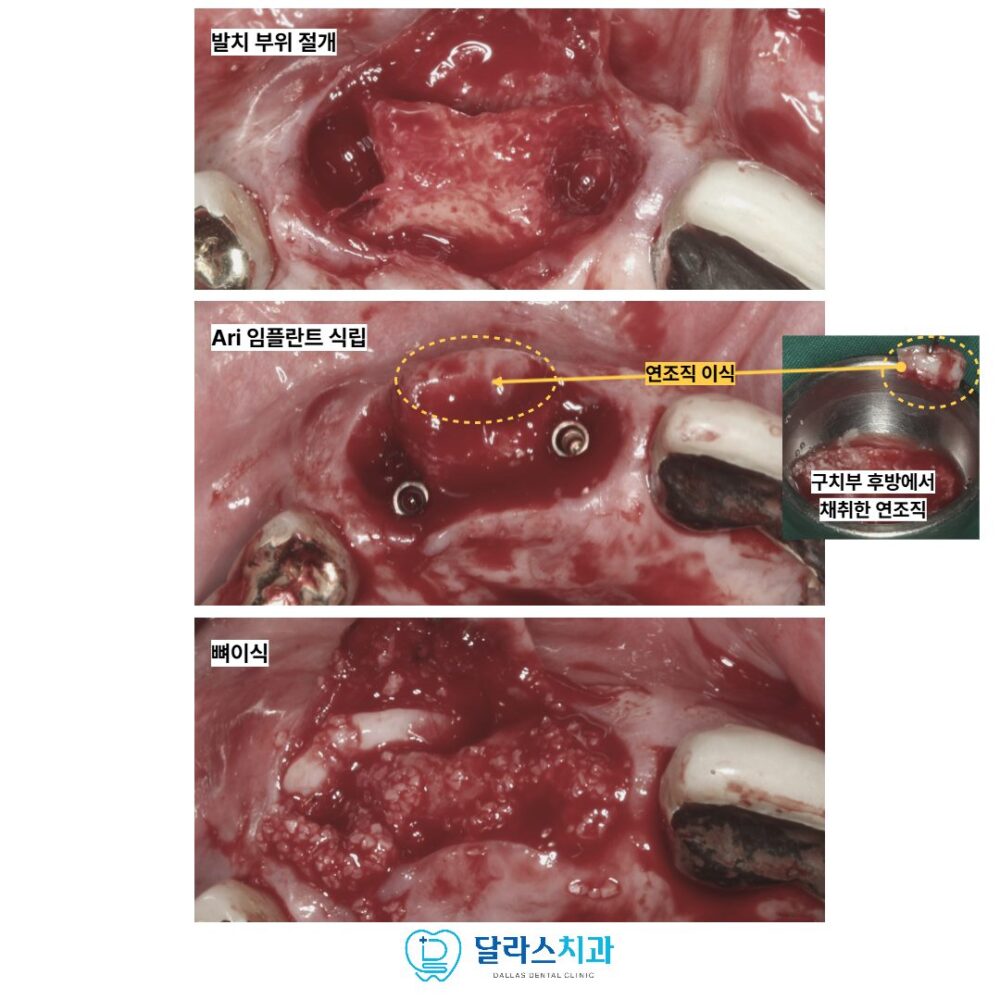 노원치과