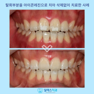 노원치과