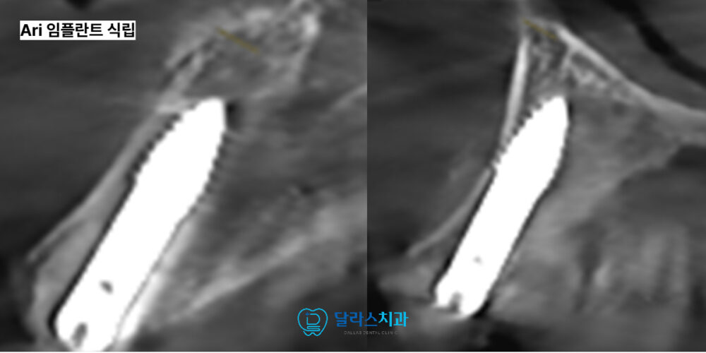 노원치과