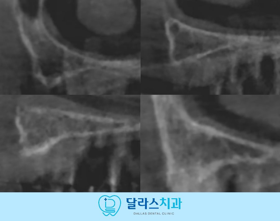 노원치과