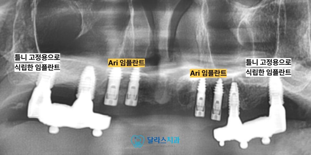 노원치과