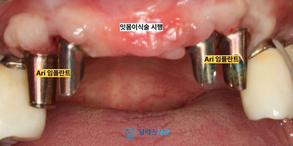 노원치과