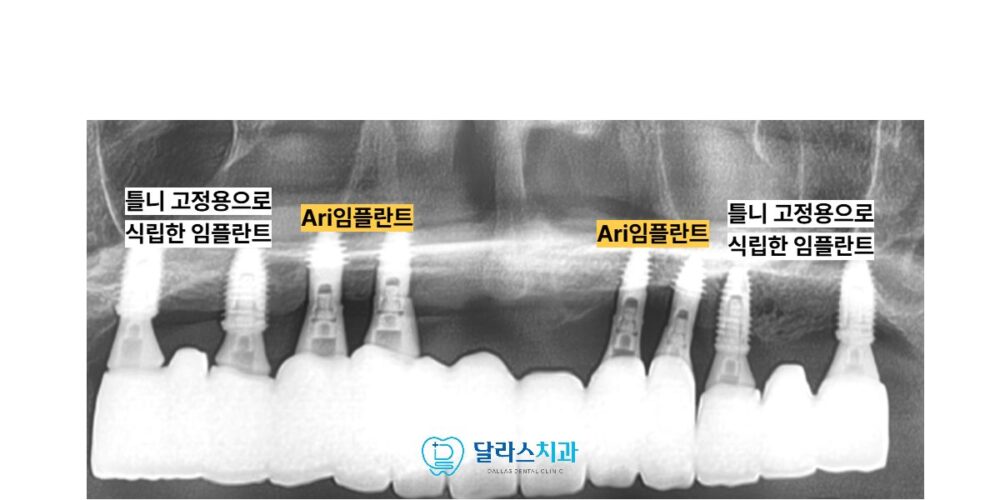 노원치과