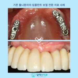 노원치과