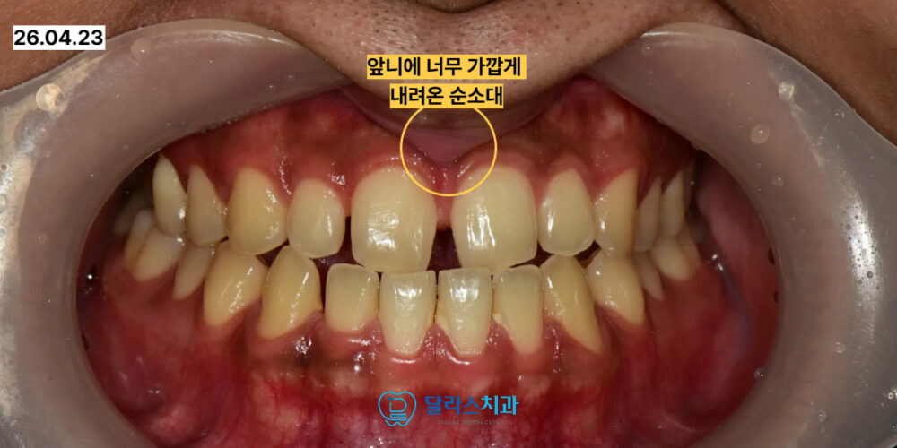 노원치과
