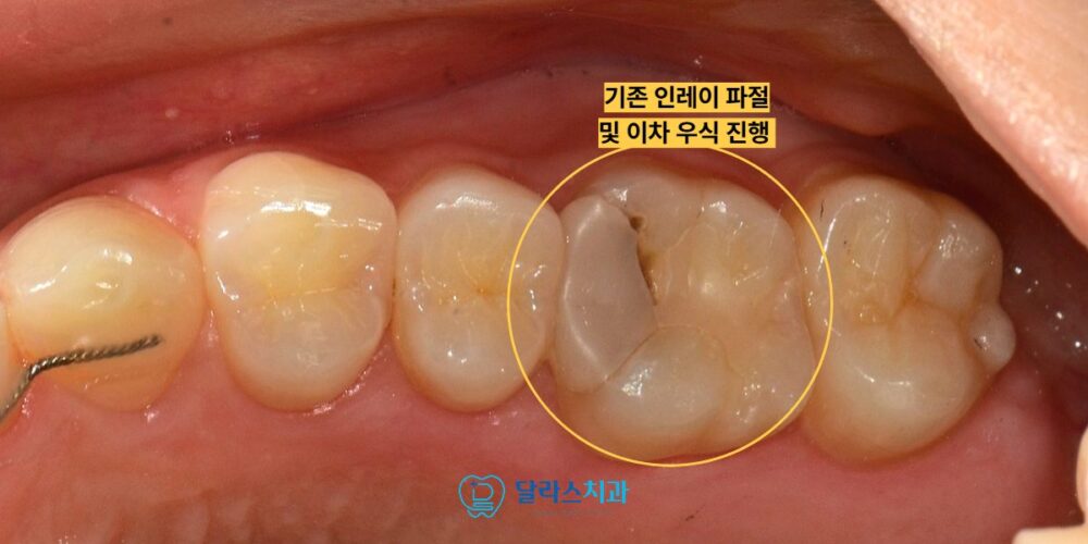 노원치과