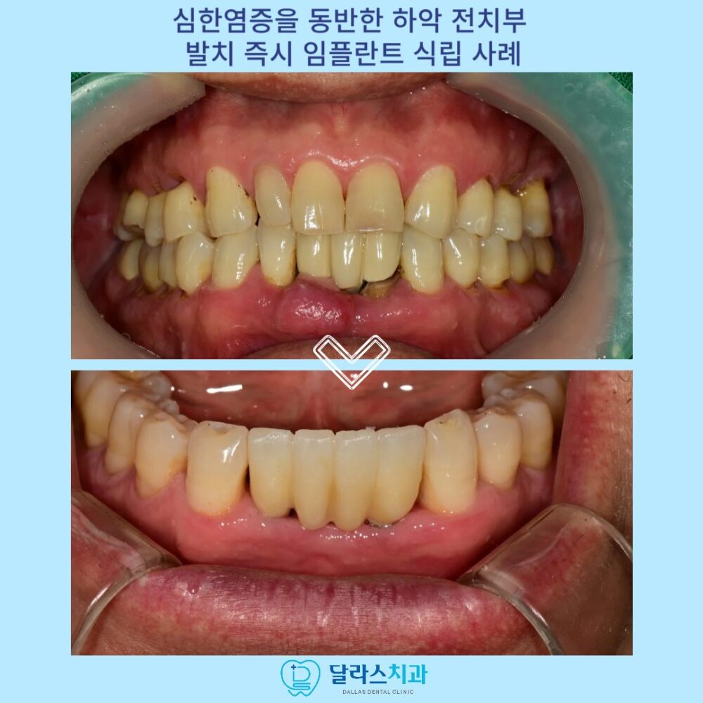 노원역치과
