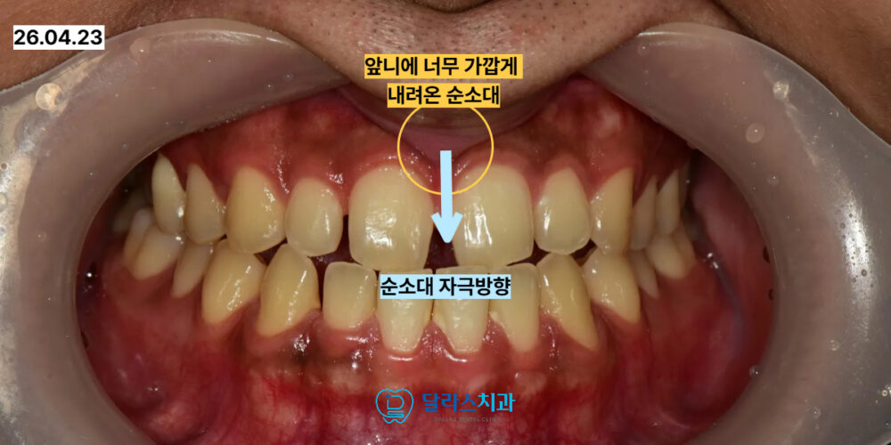 노원치과