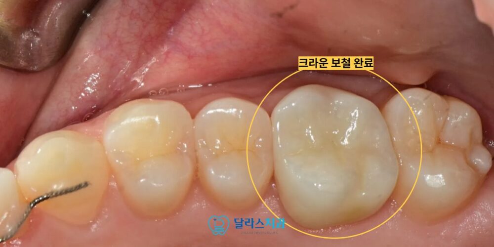 노원치과